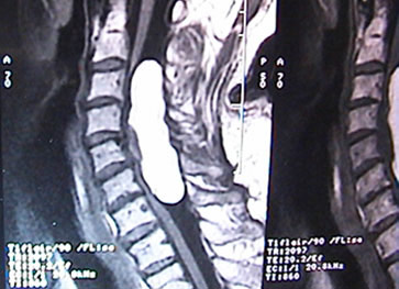 Endoscopic Brain and Spine Surgery